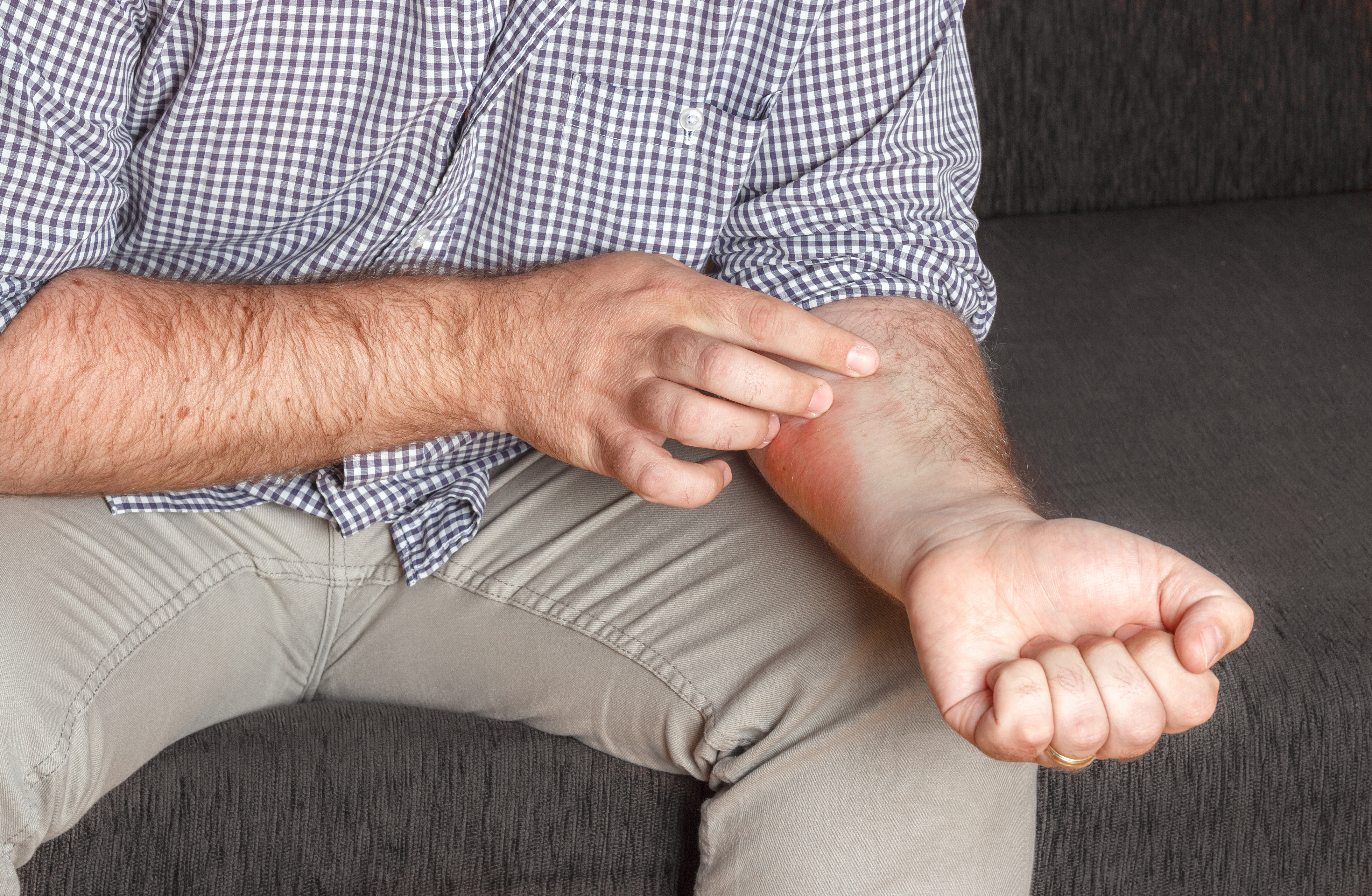 Have an allergy to rubber